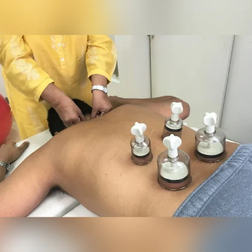 sports physio clinic Cupping Therapy at Genesis Sports Physiotherapy Clinic